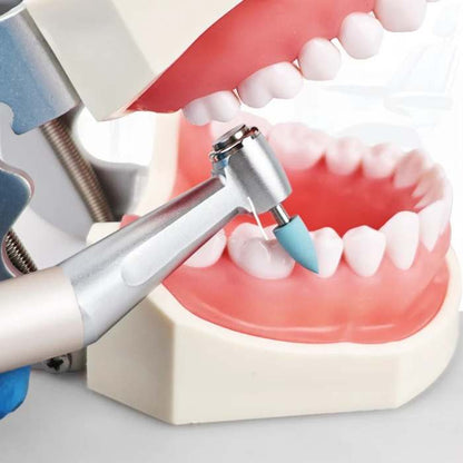 Kit per Lucidatura e Finitura della Resina – 12 Pezzi (Bassa Velocità)